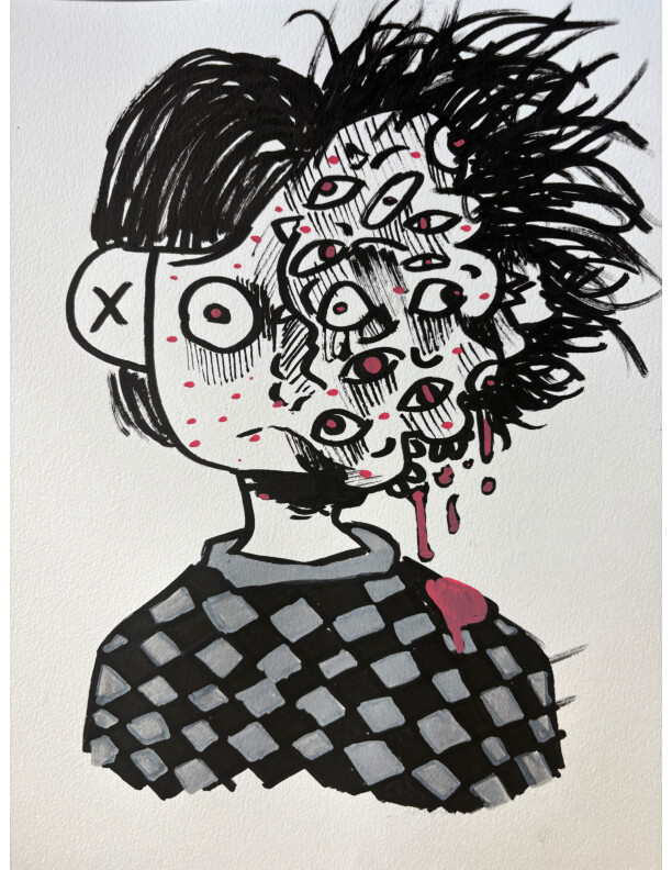 A boy with a normal looking left half of their face with a multitude of eyes and kind of pus infected looking right side of their face.